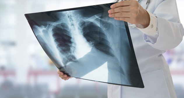 Onsite X Ray Facilities Better Health Chiropractic